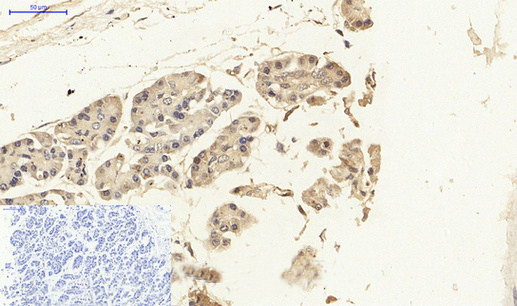 NFκB p65 Polyclonal Antibody