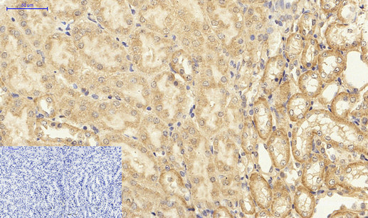 NFκB p65 Polyclonal Antibody