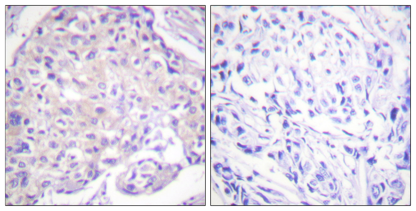 Phospho-PAK1 (Thr212) Polyclonal Antibody