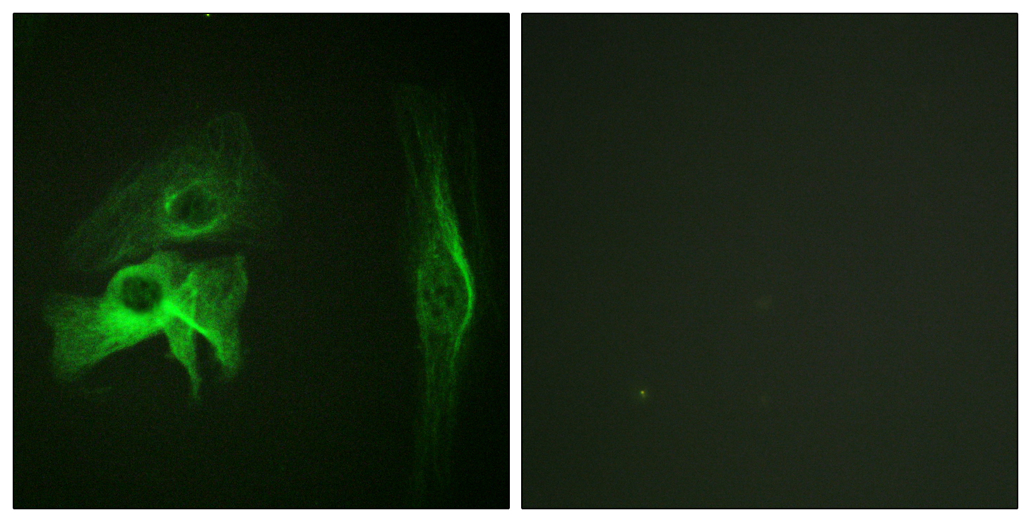 PAK1 Polyclonal Antibody