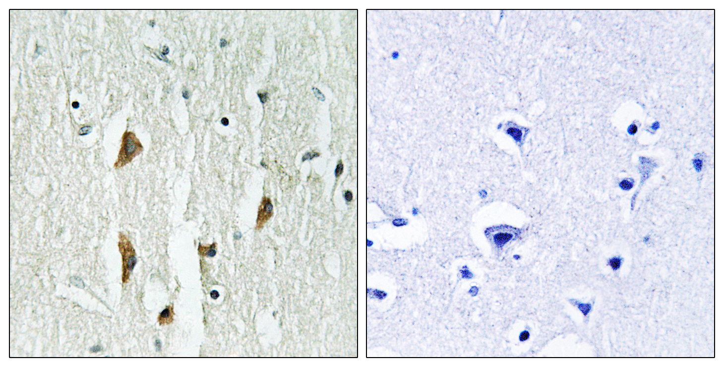 PAK1/2/3 Polyclonal Antibody