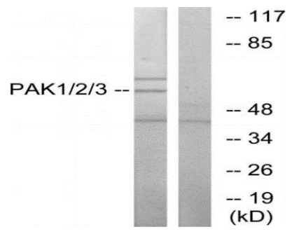 PAK1/2/3 Polyclonal Antibody