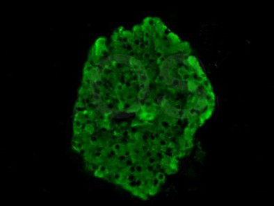 Rabbit Anti-Proinsulin antibody