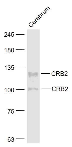 CRB2 Polyclonal Antibody