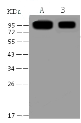 Anti-S (SARS-CoV) Mouse monoclonal antibody