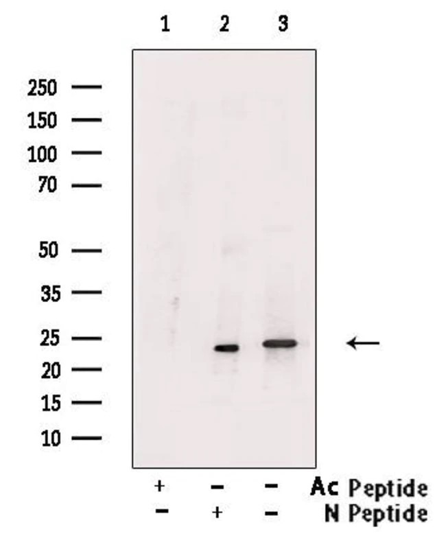 Acetyl-SOD2/MnSOD (Lys122) Antibody