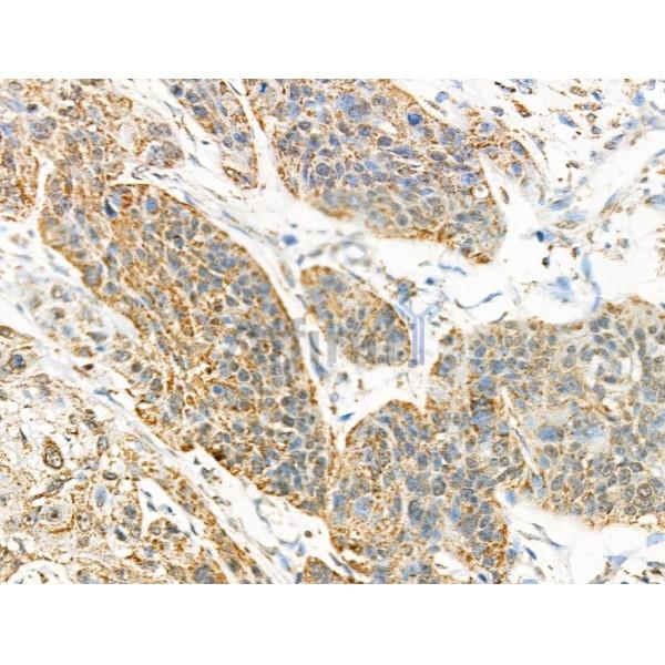 Acetyl-SOD2/MnSOD (Lys122) Antibody