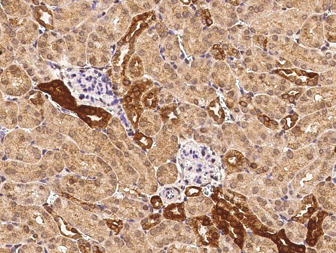 Farnesyl polyclonal antibody, FDPS