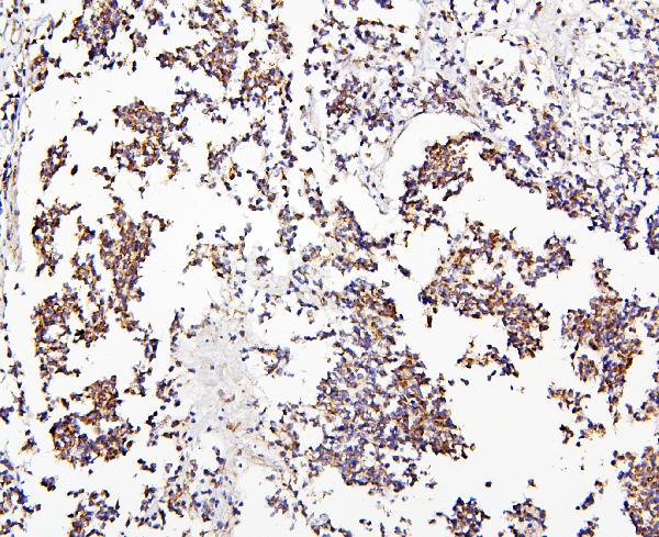 CRB1 Polyclonal Antibody