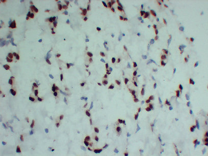 Progesterone Receptor(PR) (6P2) mouse mAb