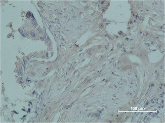 PR Monoclonal Antibody(Z15)