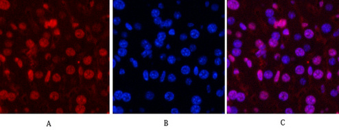 PR Monoclonal Antibody(Z15)