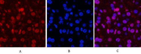 PR Monoclonal Antibody(Z15)