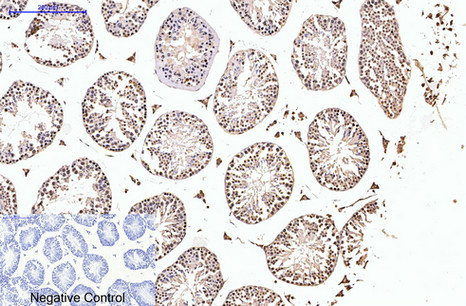 PR Monoclonal Antibody(Z15)