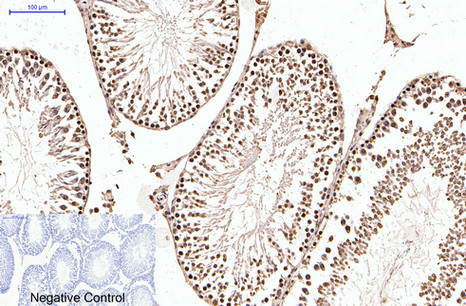 PR Monoclonal Antibody(Z15)