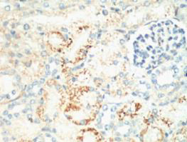 Ki 67 Monoclonal Antibody(4A8)