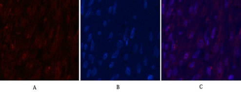 Ki 67 Monoclonal Antibody(4A8)