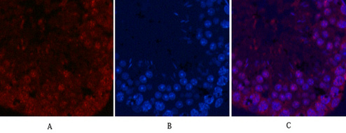 Ki 67 Monoclonal Antibody(4A8)