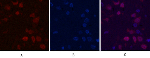 Ki 67 Monoclonal Antibody(4A8)