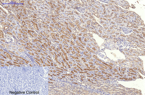 Ki 67 Monoclonal Antibody(4A8)