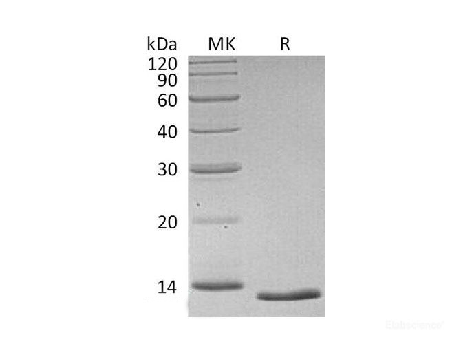 Recombinant Human Transforming Growth Factor Beta 1(TGFβ1) Protein