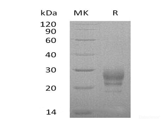 Recombinant Human Interleukin 7(IL-7) Protein