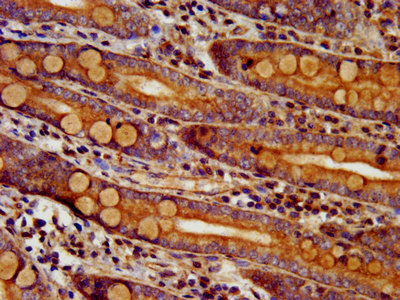 DTNBP1 Polyclonal Antibody