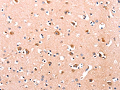 DUSP12 Polyclonal Antibody