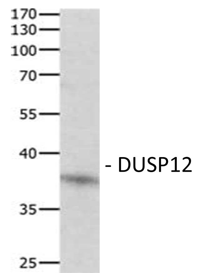 DUSP12 Polyclonal Antibody