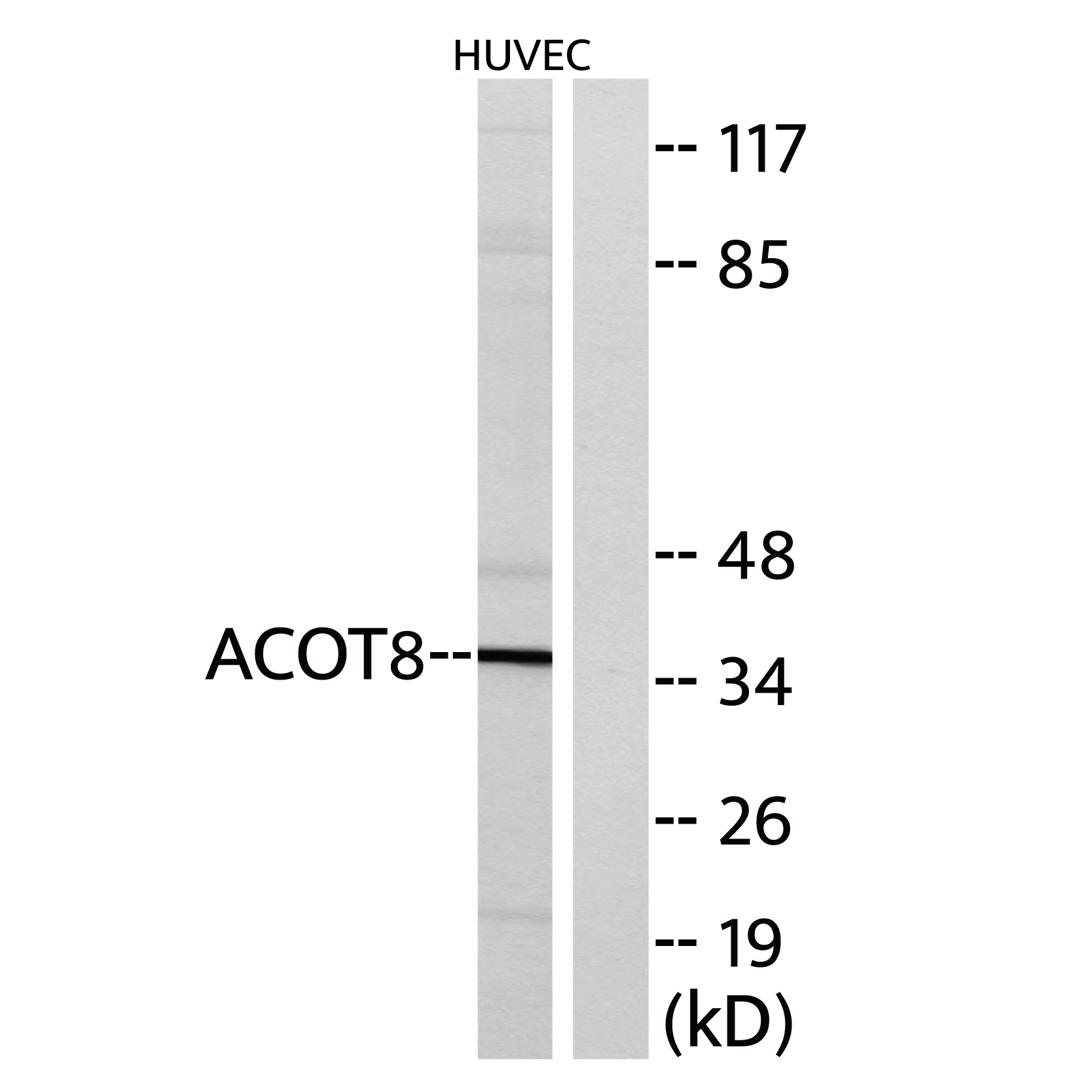 ACOT8 Rabbit pAb