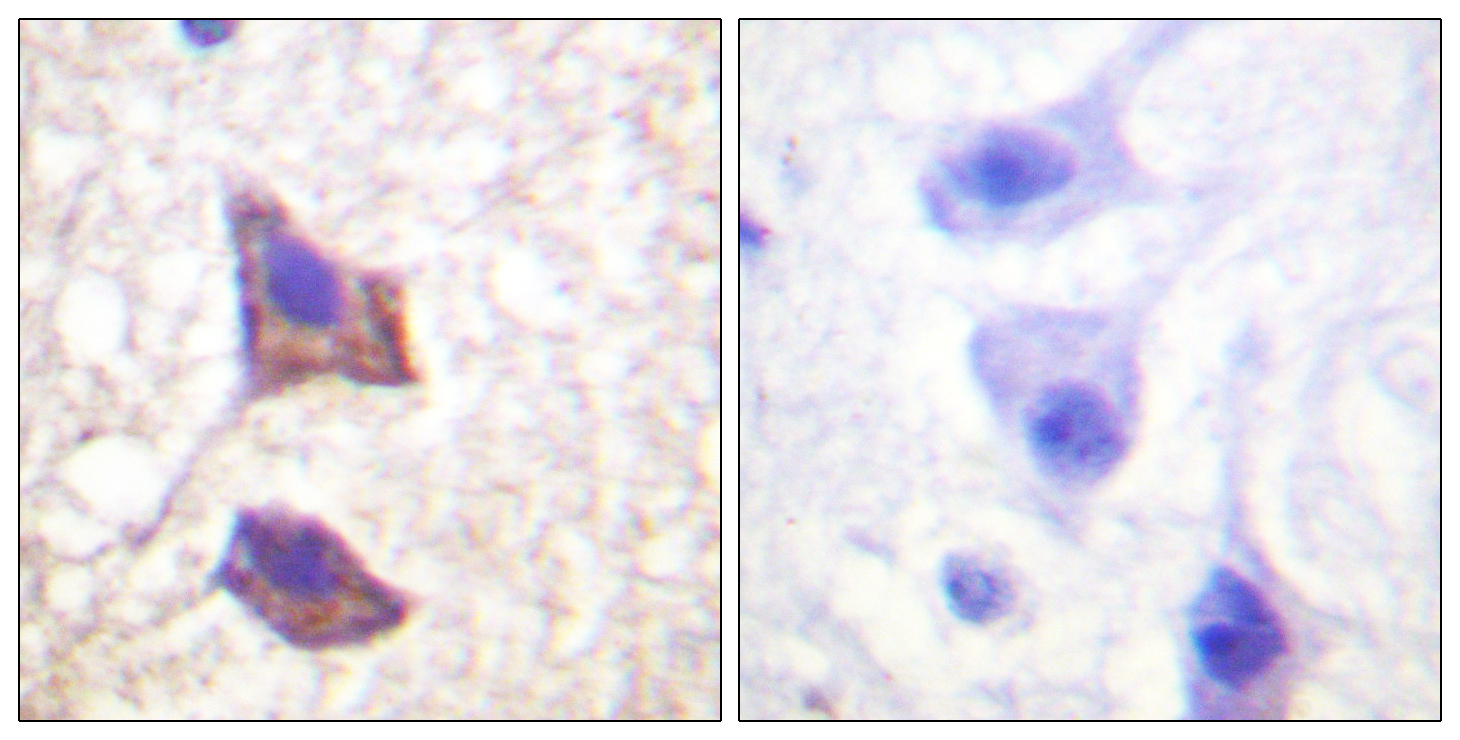 CD130 Rabbit pAb
