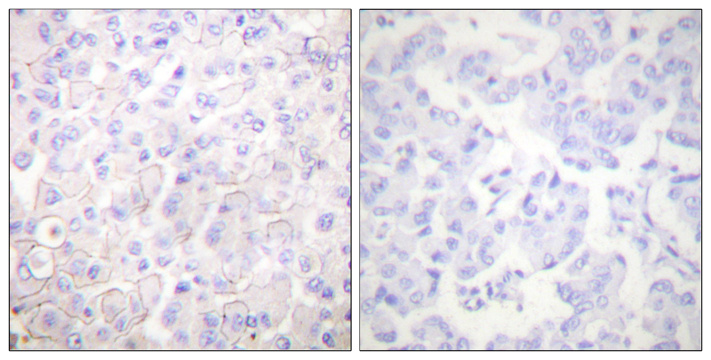 E-cadherin Polyclonal Antibody