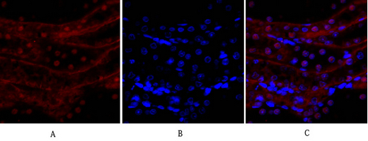 E-cadherin Polyclonal Antibody