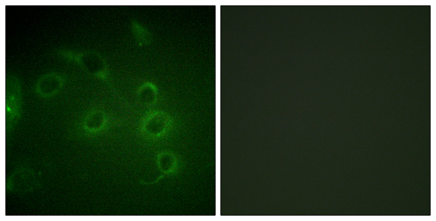 CD45 Polyclonal Antibody