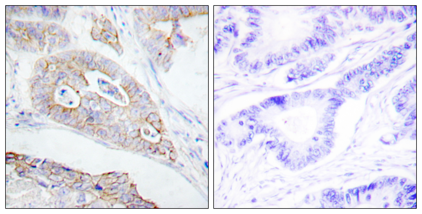 CD45 Polyclonal Antibody