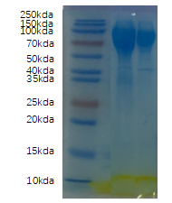 Recombinant Human ACE2 protein, His Tag