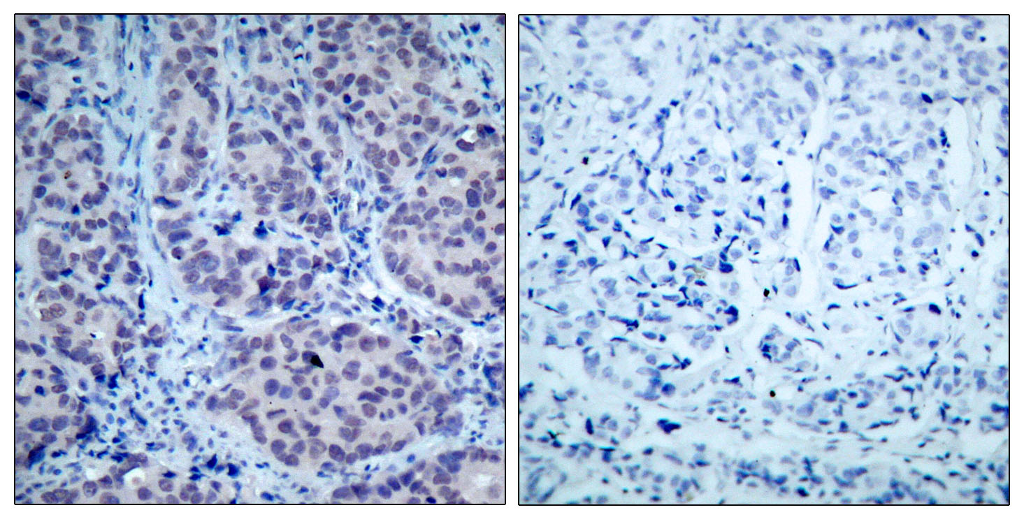 HDAC2 Polyclonal Antibody