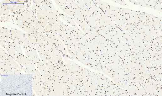 SIRT1 Polyclonal Antibody