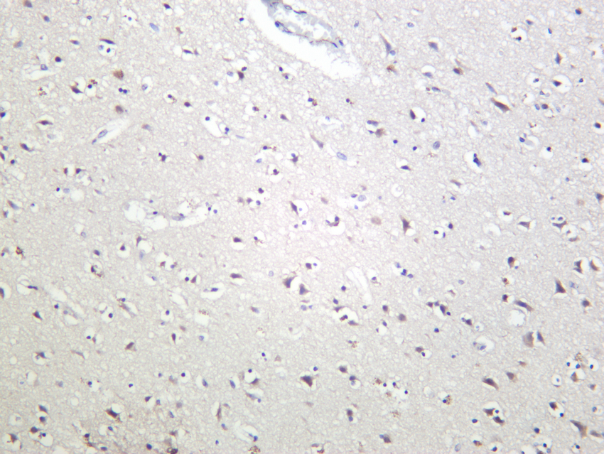 STAT3 (Phospho Ser727) (PT0911R) PT® Rabbit mAb