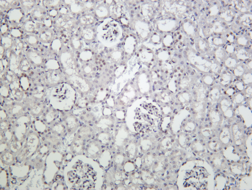 STAT3 (Phospho Ser727) (PT0911R) PT® Rabbit mAb