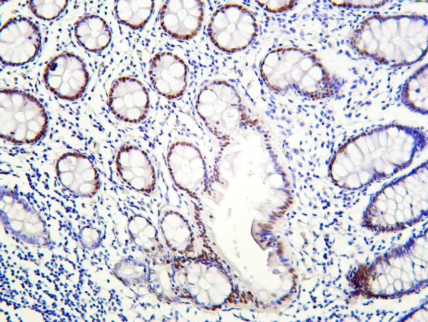 KLF4 (PT0167R) PT® Rabbit mAb