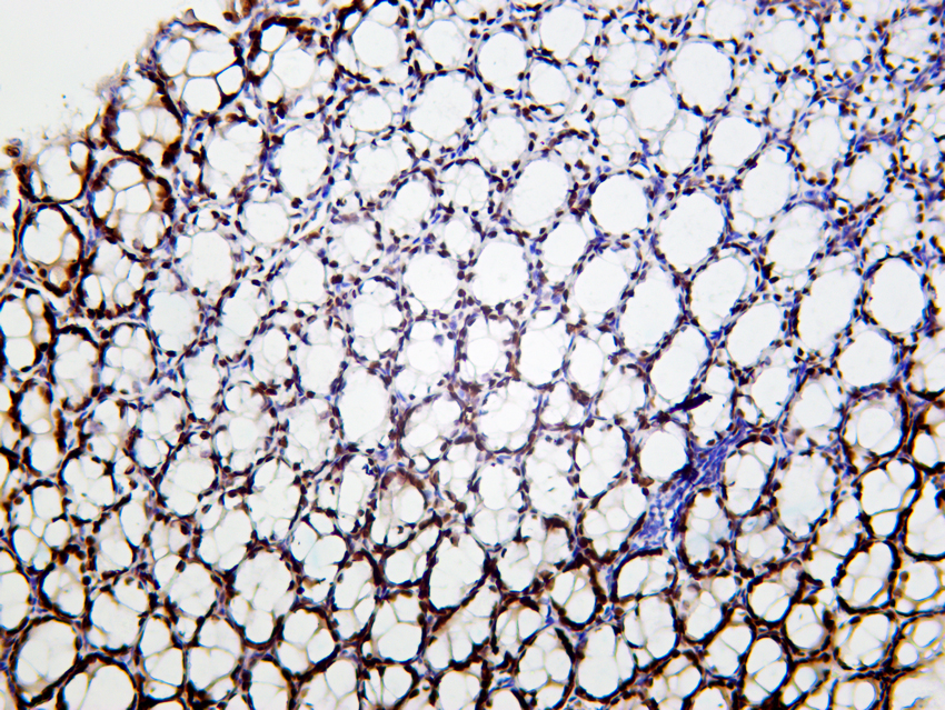 KLF4 (PT0167R) PT® Rabbit mAb