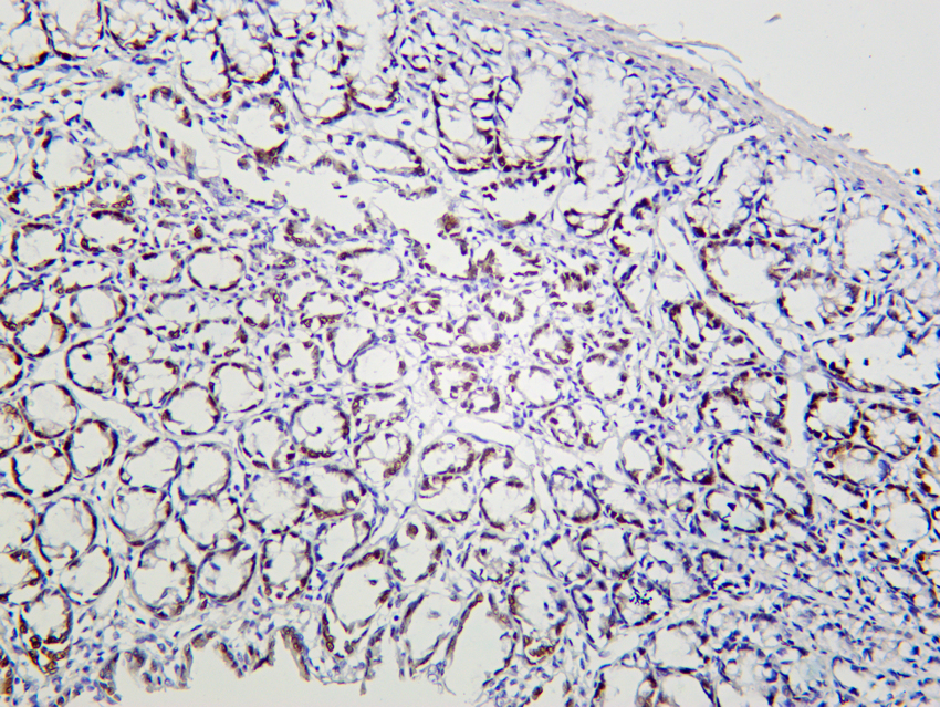 KLF4 (PT0167R) PT® Rabbit mAb