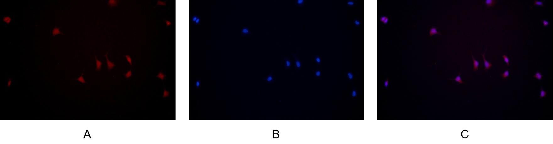JAK2 (PT0503R) PT® Rabbit mAb