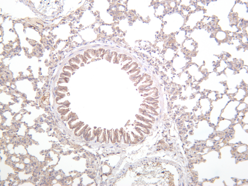 JAK2 (PT0503R) PT® Rabbit mAb