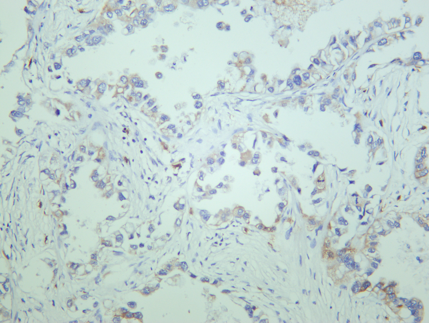 JAK1 (PT0658R) PT® Rabbit mAb