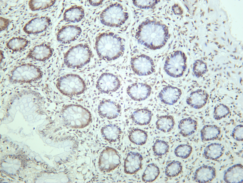 STAT3 (Phospho Tyr705) (PT0742R) PT® Rabbit mAb