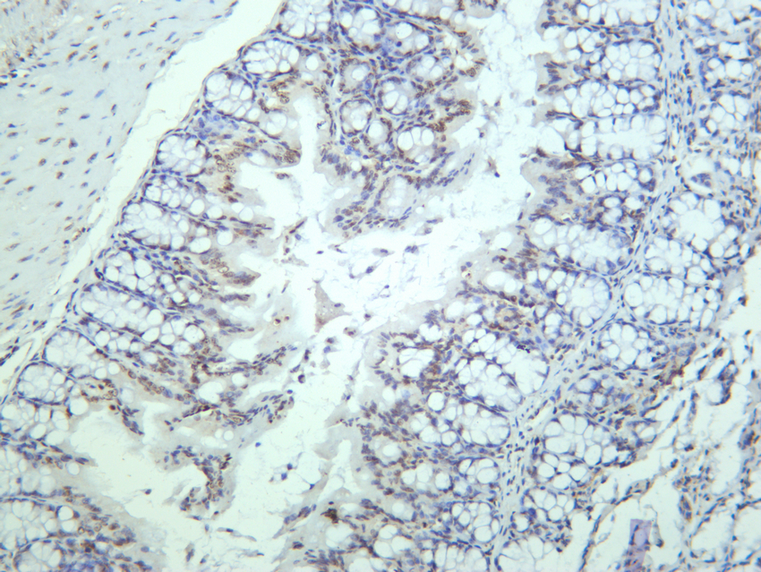 STAT3 (Phospho Tyr705) (PT0742R) PT® Rabbit mAb