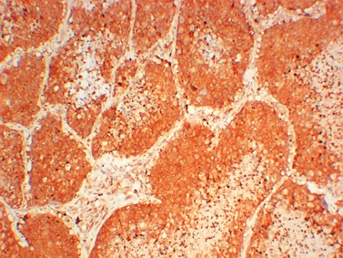 JAK3 (6B5) Mouse mAb