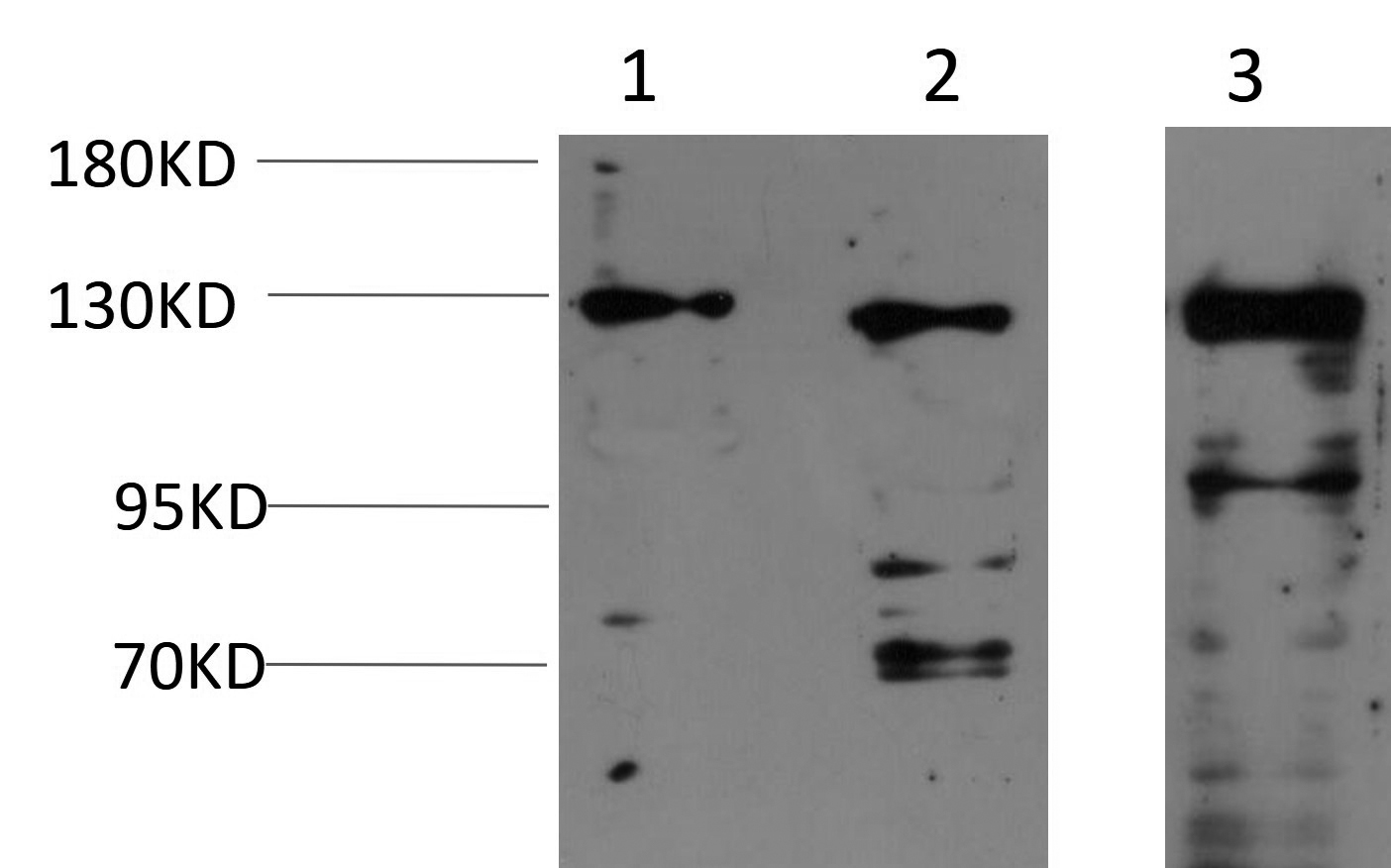 JAK1 (3F12) Mouse mAb
